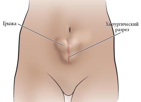 Почему некоторым людям сложнее выполнять физические упражнения